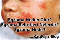 Egzama Neden Olur