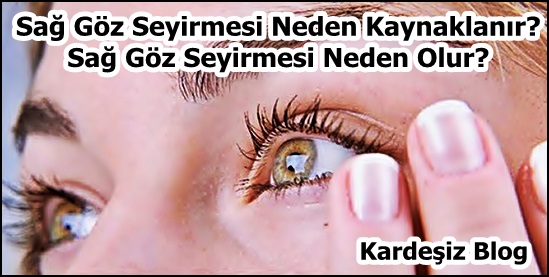 Sag Goz Seyirmesi Neden Kaynaklanir Sag Goz Seyirmesi Neden Olur