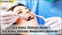 Diş Kökü iltihabı Nedir