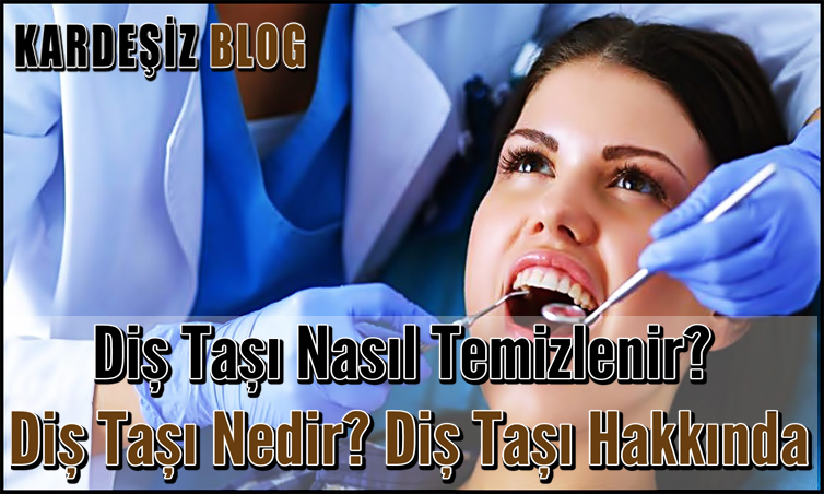 Diş Taşı Nasıl Temizlenir