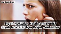 Siyah Noktalar Nasıl Temizlenir