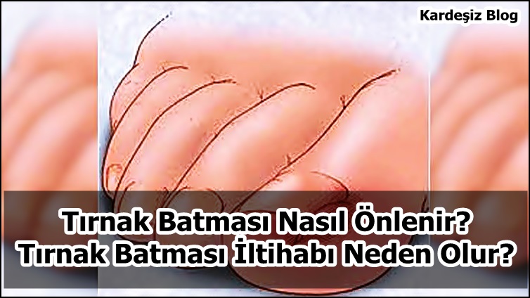 Tırnak Batması Nasıl Önlenir