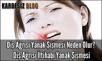 Diş Ağrısı Yanak Şişmesi Neden Olur
