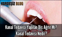 Kanal Tedavisi Yapılan Diş Ağrır Mı
