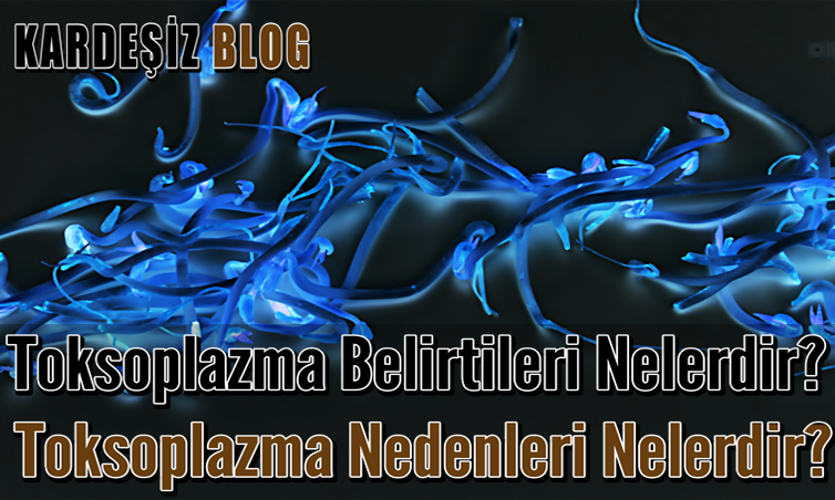 Toksoplazma Belirtileri Nelerdir