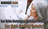 Sarı Nokta Hastalığının Belirtileri Nelerdir