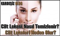 Cilt Lekesi Nasıl Temizlenir