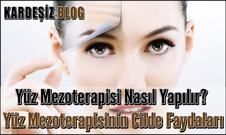 Yüz Mezoterapisi Nasıl Yapılır