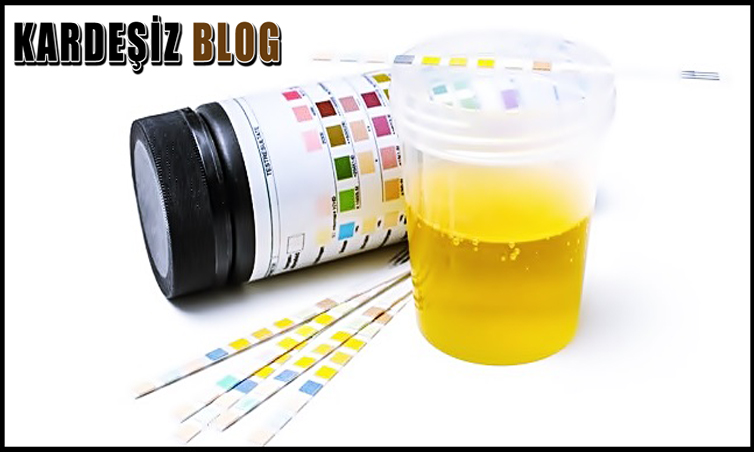 İdrar Neden Beyaz Renk Olur