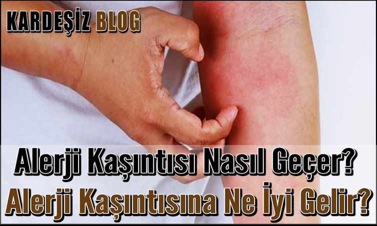 Alerji Kaşıntısı Nasıl Geçer? Alerji Kaşıntısına Ne İyi Gelir?