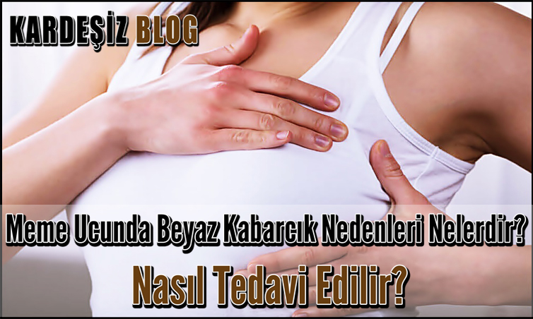 Meme Ucunda Beyaz Kabarcık Nedenleri Nelerdir