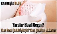 Yaralar Nasıl Geçer
