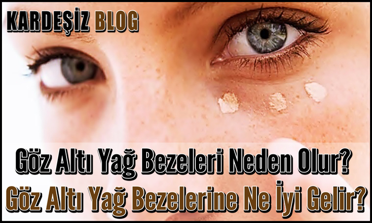 Göz Altı Yağ Bezeleri Neden Olur