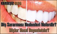 Diş Sararması Nedenleri Nelerdir