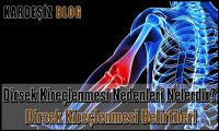 Dirsek Kireçlenmesi Nedenleri Nelerdir