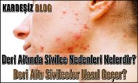 Deri Altında Sivilce Nedenleri Nelerdir