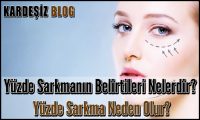 Yüzde Sarkmanın Belirtileri Nelerdir