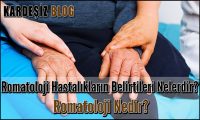 Romatoloji Hastalıkların Belirtileri Nelerdir