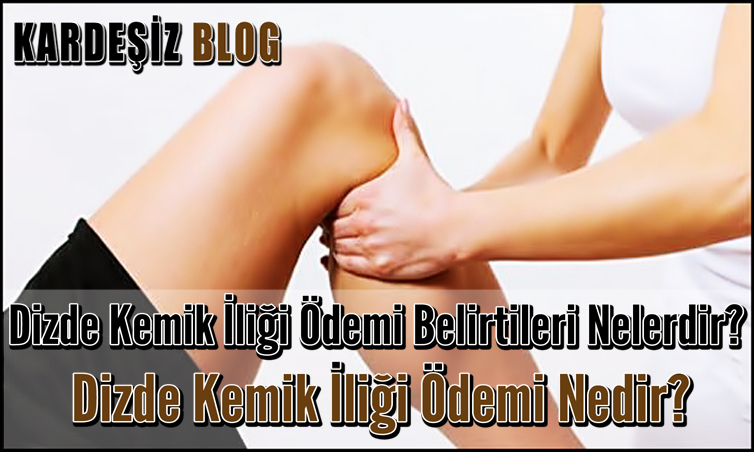 Dizde Kemik iliği Ödemi Belirtileri Nelerdir