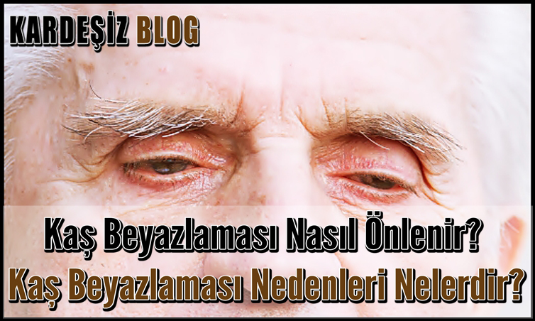 Kaş Beyazlaması Nasıl Önlenir