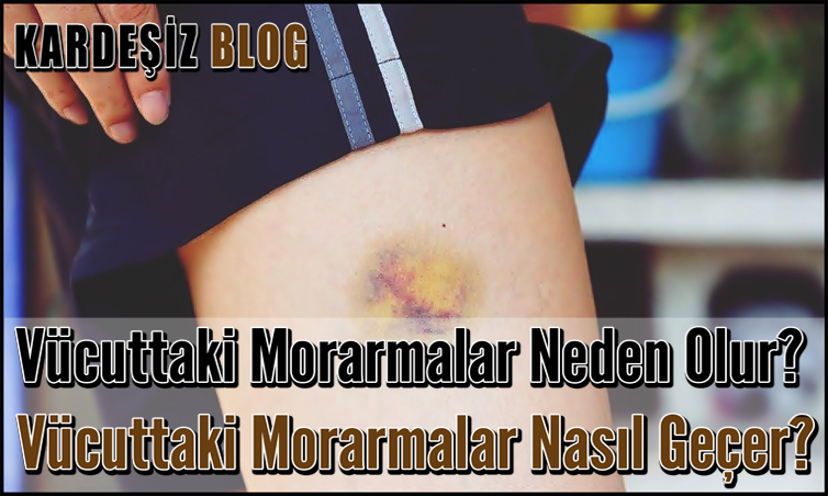 Vücuttaki Morarmalar Neden Olur