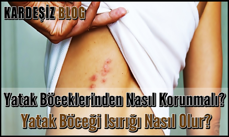 Yatak Böceklerinden Nasıl Korunmalı