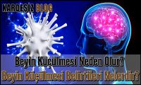 Beyin Küçülmesi Neden Olur
