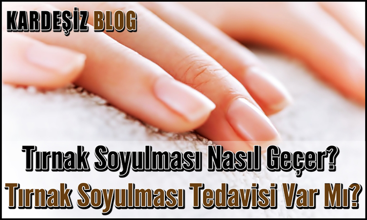 Tırnak Soyulması Nasıl Geçer