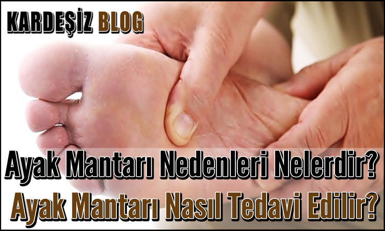 Ayak Mantarı Nedenleri Nelerdir