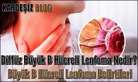 Diffüz Büyük B Hücreli Lenfoma Nedir