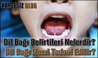 Dil Bağı Belirtileri Nelerdir