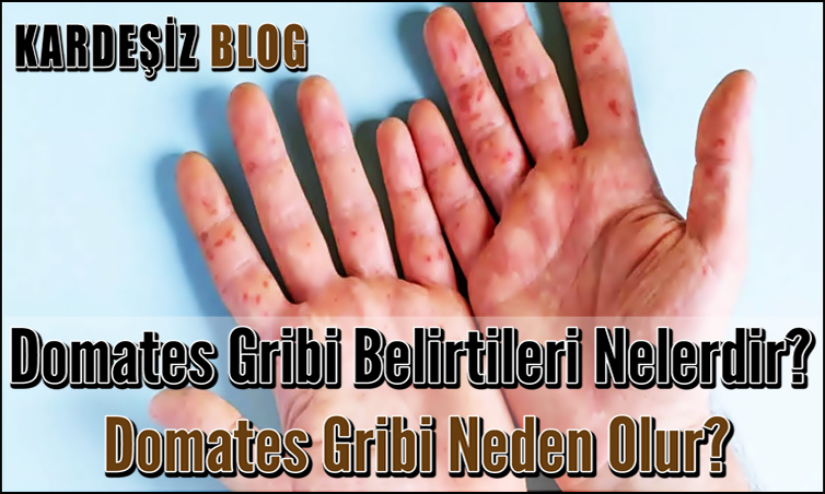 Domates Gribi Belirtileri Nelerdir