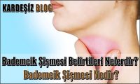 Bademcik Şişmesi Belirtileri Nelerdir