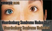 Waardenburg Sendromu Neden Olur