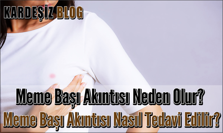 Meme Başı Akıntısı Neden Olur