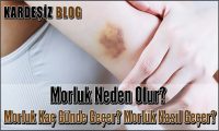 Morluk Neden Olur