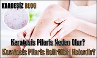 Keratosis Pilaris Neden Olur