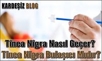 Tinea Nigra Nasıl Geçer