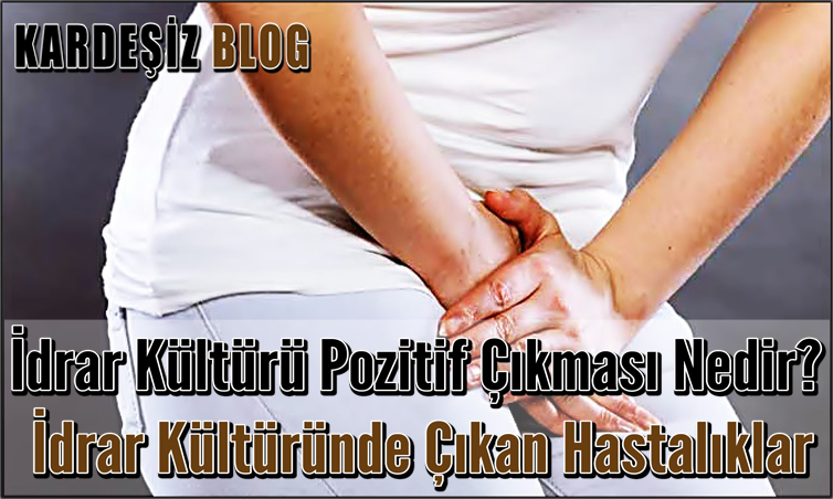 idrar Kültürü Pozitif Çıkması Nedir