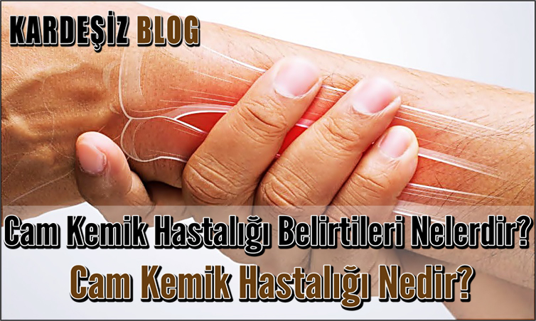 Cam Kemik Hastalığı Belirtileri Nelerdir