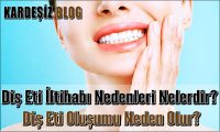Diş Eti iltihabı Nedenleri Nelerdir