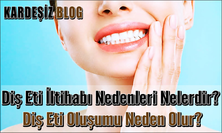 Diş Eti iltihabı Nedenleri Nelerdir
