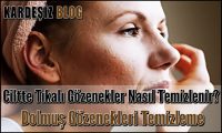 Ciltte Tıkalı Gözenekler Nasıl Temizlenir