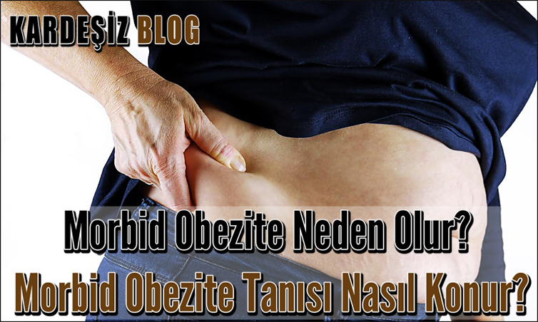 Morbid Obezite Neden Olur