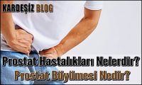 Prostat Hastalıkları Nelerdir