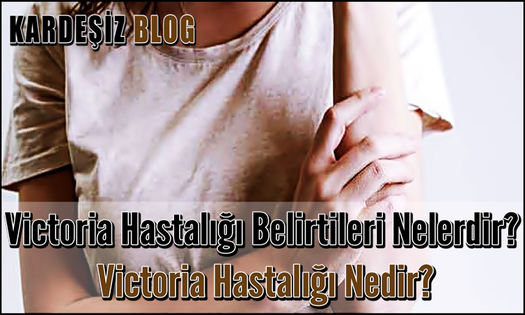 Victoria Hastalığı Belirtileri Nelerdir