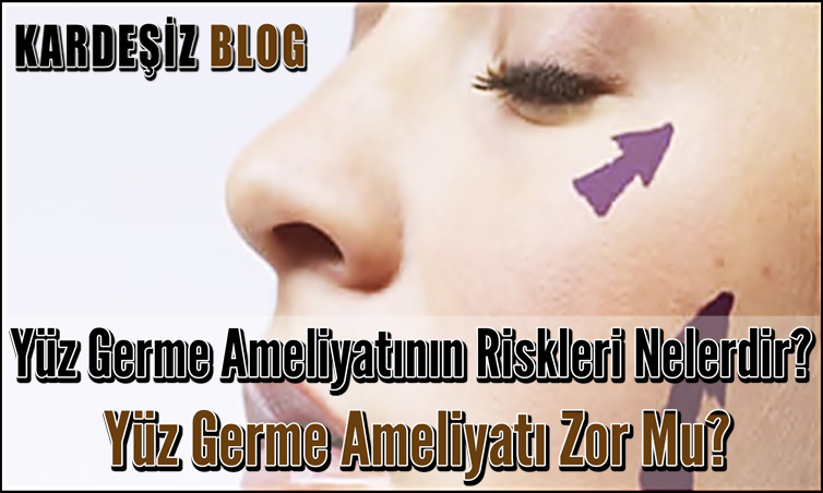 Yüz Germe Ameliyatının Riskleri Nelerdir