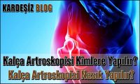 Kalça Artroskopisi Kimlere Yapılır