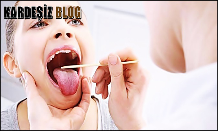 Boğaz iltihaplanması Ne Kadar Sürer