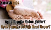 Ayak Topuğu Neden Çatlar